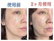 使ってよかった！噂の美容液を2ケ月ぬった49歳、顔の老けサインに見られた変化