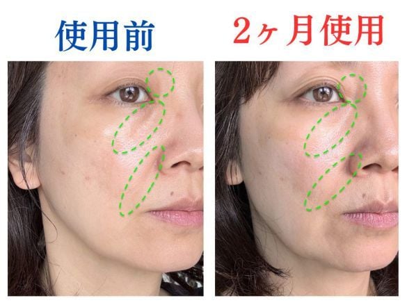 使ってよかった！噂の美容液を2ケ月ぬった49歳、顔の老けサインに見られた変化
