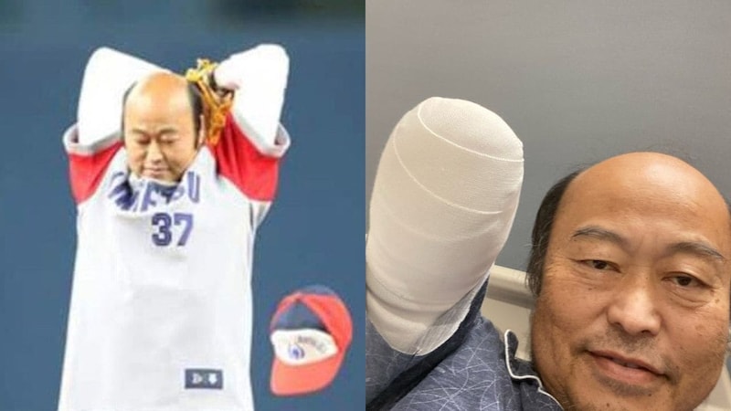 〈このままだと5年しか生きられない〉右腕切断も合併症の脅威おさまらず…“ピッカリ投法” 佐野慈紀さんが明かす糖尿病の恐ろしさ【2025 スポーツ記事 4位】