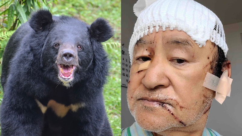 〈「クマを殺すな」の抗議殺到も…〉頭皮をはがされ頭蓋骨がむきだしになった被害者男性が独白「あの凶暴性はやられないとわからない」【2025 クマ被害記事 1位】