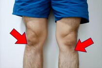 【賛否】短パン男性は《すね毛》を剃るべきなのか？　SNS「すね毛キモい」「汚くて不快」相次ぐも「気にならない」擁護派も