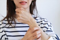 【閲覧注意】あなたの体にもできている？　「赤いほくろのようなもの」の正体とは？