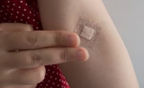 【画像】採血後に「青あざ」できたことある？→これが「実際の写真」です（閲覧注意）