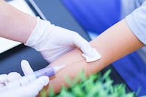 【疑問】健康診断で採血をする腕は左or右、どっちなの？　実は手の甲＆足の血管使うケースも…「針」を刺す部位の決め方とは【医師が解説】