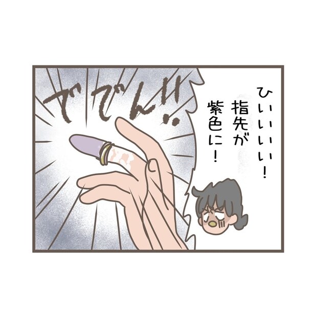 【漫画】「指が紫に…」無理やりはめた指輪が抜けない！　駆け込んだ“意外な場所”に「覚えておきます」の声