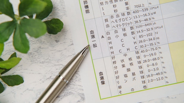 ただの「貧血」じゃない！？　健康診断で「赤血球の数値低い」と指摘されたら放置NGの理由【医師解説】