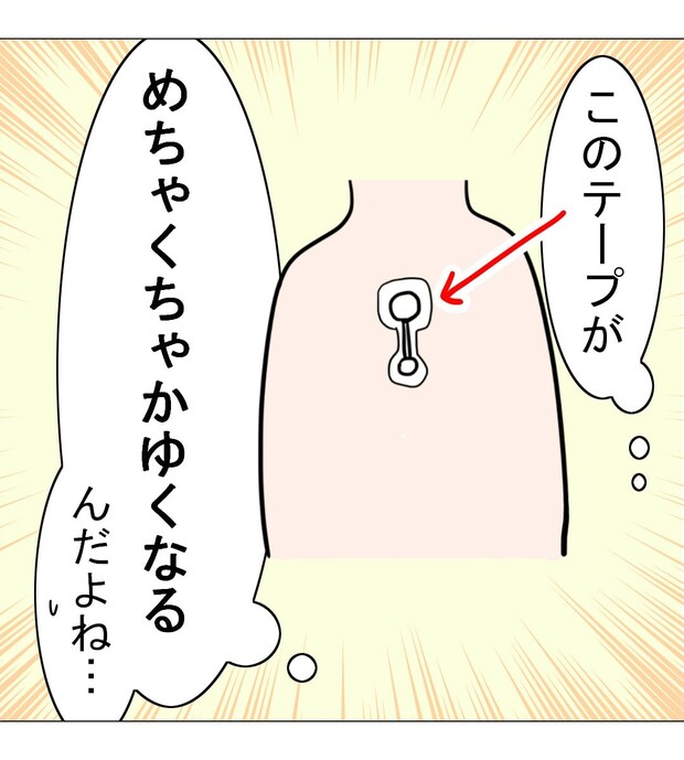 【漫画】不整脈検査で“ホルター心電図”を装着「あれ？意外と平気かも」　医療の進化に驚き！