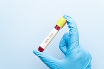 「腫瘍マーカー」が正常なら安心？　実は早期がん発見には不向き…内視鏡専門医が教える“本当に受けるべき検査”とは