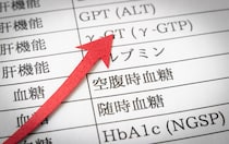 心当たりがないのに1年前より「空腹時血糖値」高い…見落としがちな“5つの原因”とは【糖尿病専門医が解説】