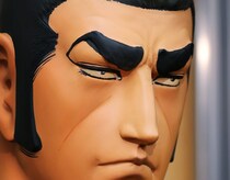 顔が老けて見える「ゴルゴ線」　出てきたらどう対処したらよい？