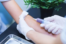 【健康診断】採血後、注射部分に「あざ」…内科医に聞いてわかった「あざ」できやすい人にありがちな5つの“特徴”