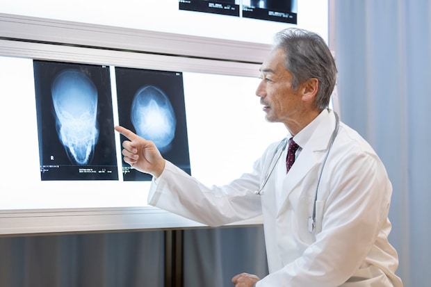 健康診断で「脳腫瘍の疑い」と診断…「完治」できるの？　手術後の再発リスク＆退院後の注意点とは【脳外科医が解説】