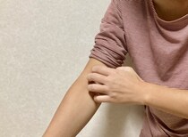 【閲覧注意】見つけたら必ず取り除いて！　これが「トコジラミ」の画像です