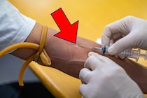 【えっ】採血時「血管がなかなか出てこない…」→実は「血管が見つかりにくい人」には特徴があった