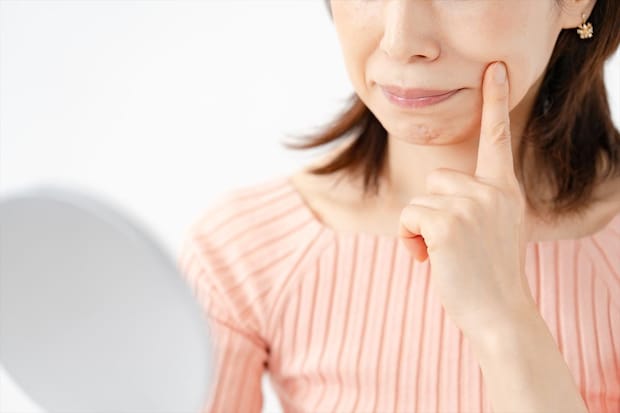 口元が突き出る「口ゴボ」 “口呼吸”が顔立ちを変えてしまう? 放置NGの“リスク”を歯科医師が解説