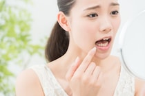 【歯科医師が回答】笑うと「歯茎」が目立つ…「ガミースマイル」はなぜ起こる？　実際の写真もチェック