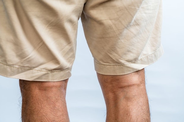 「職場のハーフパンツ」どこまでOK？　だらしなく見えない境界線と、失敗しないマナーの基準とは
