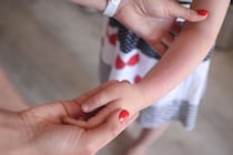 夏本番の前に…知っておきたい“肌トラブル”　子どものあせも・かぶれ・アトピーの見分け方＆受診の目安【皮膚科専門医・解説】