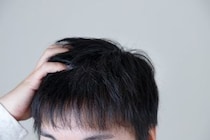 「頭皮が臭い」と言われショック…どうすれば治る？