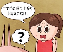 【漫画】「ニキビが消える」SNS動画を信じ込む親子が来店…　美容部員もお手上げの結末に！