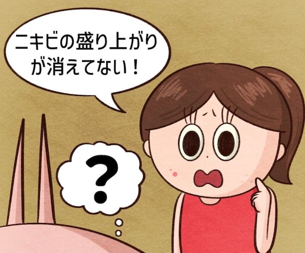 【漫画】「ニキビが消える」SNS動画を信じ込む親子が来店…　美容部員もお手上げの結末に！