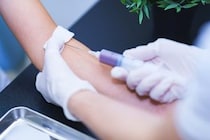 【専門医解説】「糖尿病」の数値、実は夏に下がる！？　指標「HbA1c」の改善に潜む“落とし穴”とは