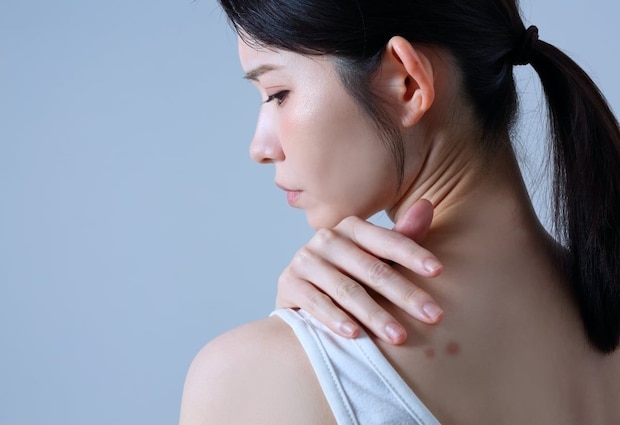 見えない「背中汚れ」6割以上が放置!? 背中ニキビを防ぐ“効果的な洗い方”とは【美容皮膚科医が解説】