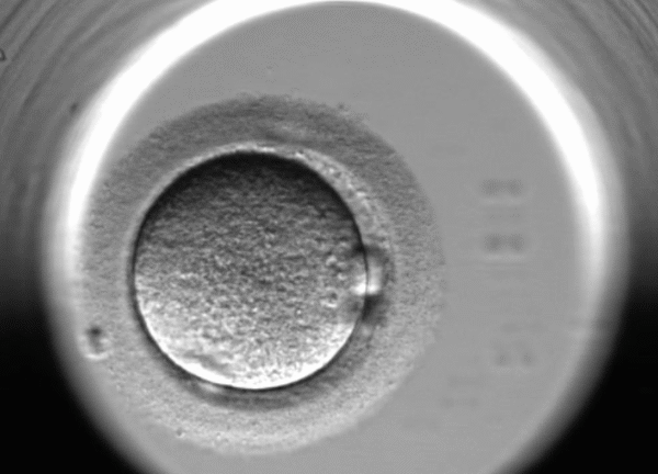 活性化したヒト人工受精卵