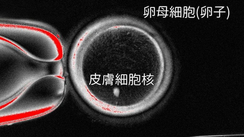 ヒト皮膚細胞から卵子を作り受精させ初期胚まで成長させることに成功!