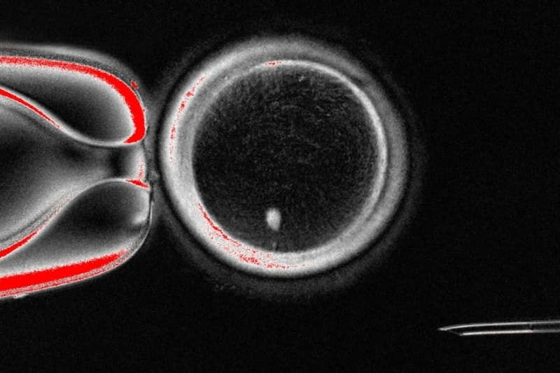ヒト皮膚細胞から卵子を作り受精させ初期胚まで成長させることに成功!