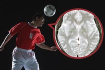 ヘディング多用者は「脳の灰白質と白質の境界が”にじんでいる”」と判明