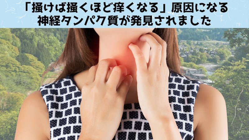 皮膚をかくと「かゆみを増加」させるタンパク質を発見！