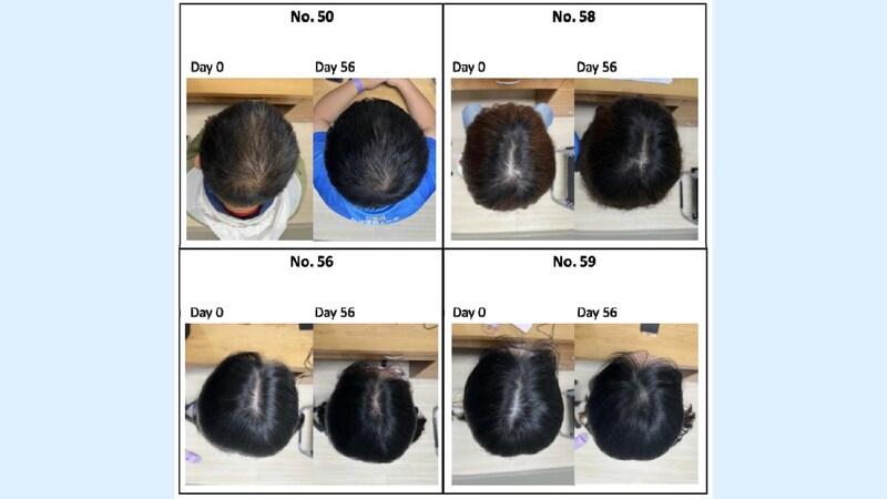 ０日目と５６日目の髪の比較。見た目でも大きく増えていることがわかります
