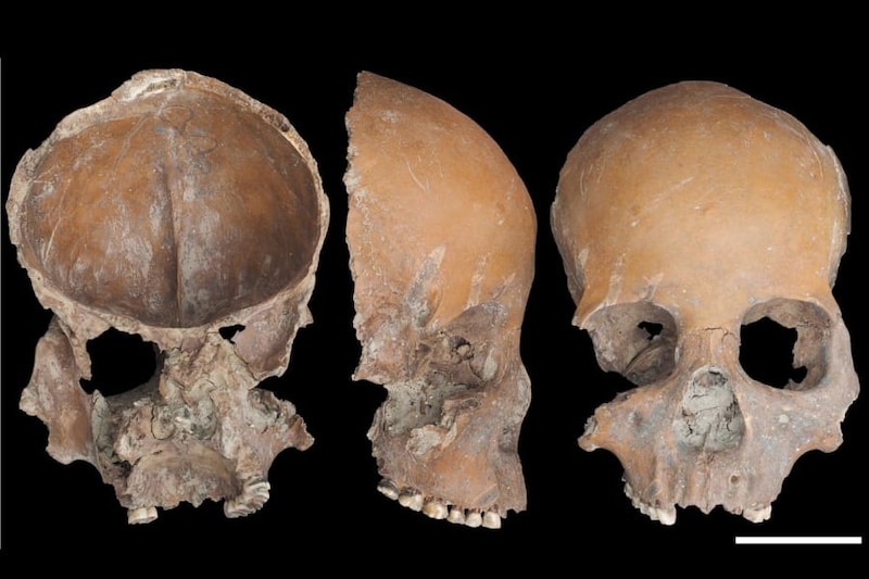 祖先の人骨を「コップ」に加工、5000年前の証拠を発見