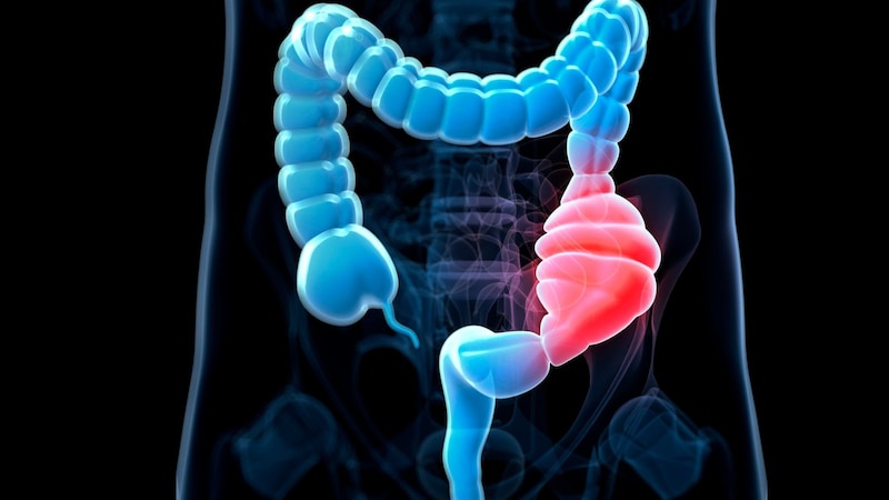 まとめ：便秘対策は『繊維だけ』の時代から『選ぶ時代』へ