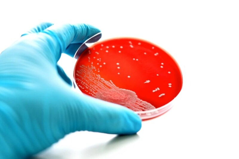 3歳児が実験皿で培養していた「淋菌」を誤食してしまった事件