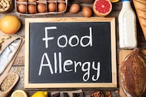 子どもの食物アレルギーが増えたのは医療の誤った指導に一因があった