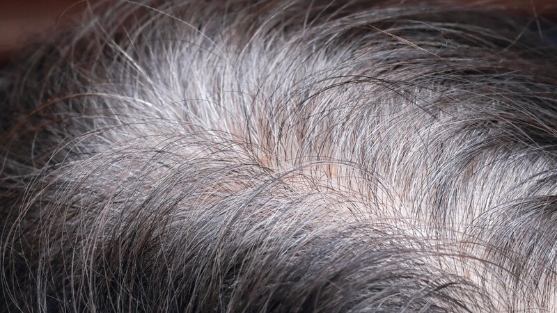 【東大】白髪が増えるのはがんを防ぐため――「白髪＝悪」の常識を覆す！