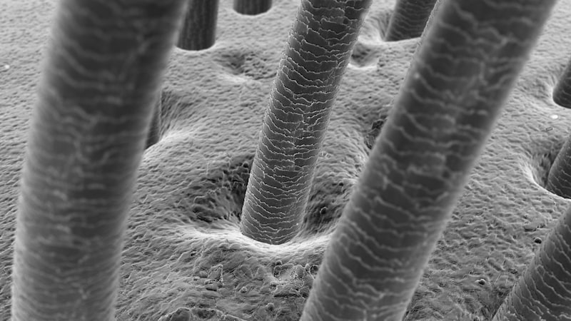 まとめ：白髪化に代表される老化は体を「がん」から守っている