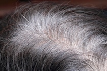 【東大】白髪が増えるのはがんを防ぐため――「白髪＝悪」の常識を覆す！