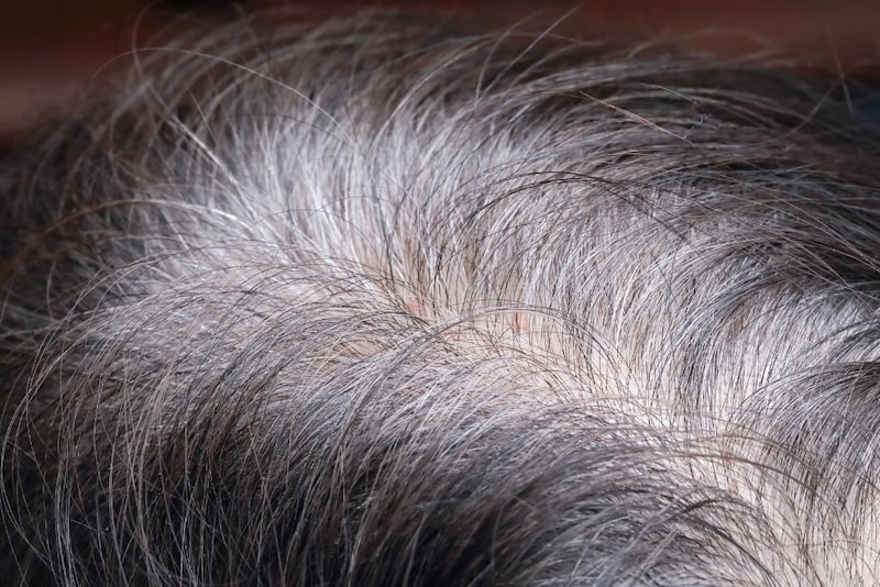 【東大】白髪が増えるのはがんを防ぐため――「白髪＝悪」の常識を覆す！