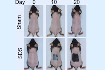 「傷跡にやたら毛が生えてくる」仕組みを利用した発毛法を発見