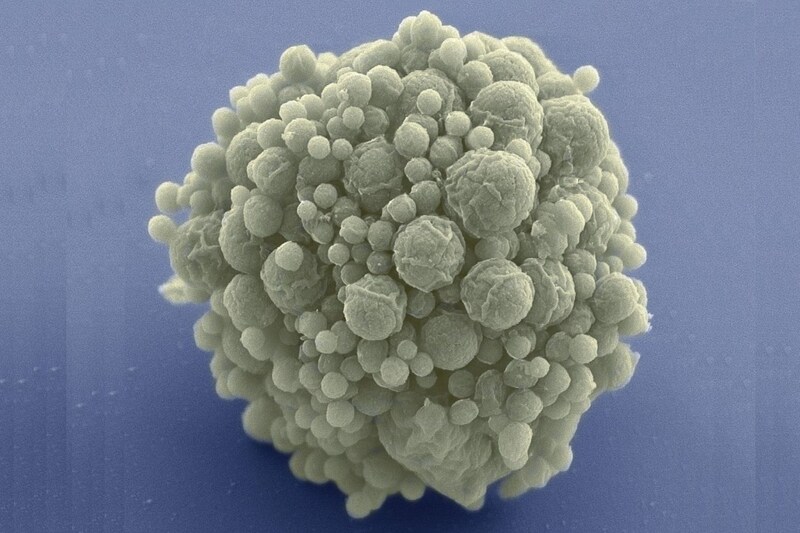 極限まで遺伝子を削った人工細胞でも進化は可能なのか?