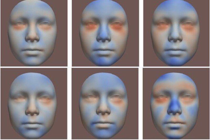 妊娠中は例え少量でもアルコール摂取が「子供の顔」を変形させてしまう！