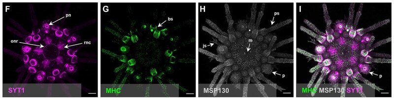 人間はずっとウニを誤解していた