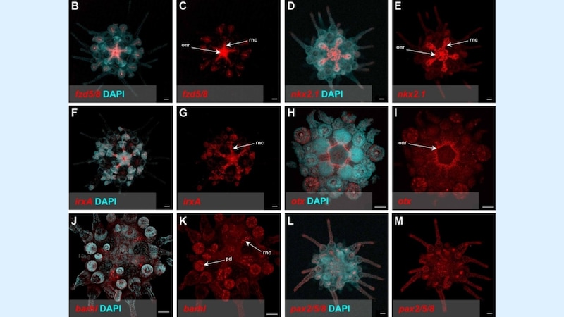 ウニの体は「巨大な脳」だった