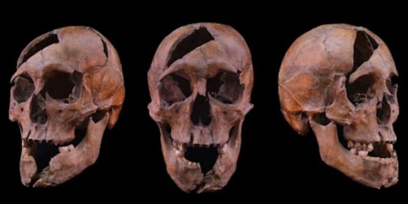 1272年に暗殺された公爵――26ヵ所の傷でオーバーキルされていた