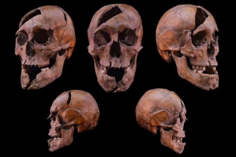 1272年に暗殺された公爵――26ヵ所の傷でオーバーキルされていた