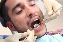 男性が歯周病になりやすい理由が判明！原因は”免疫”だった