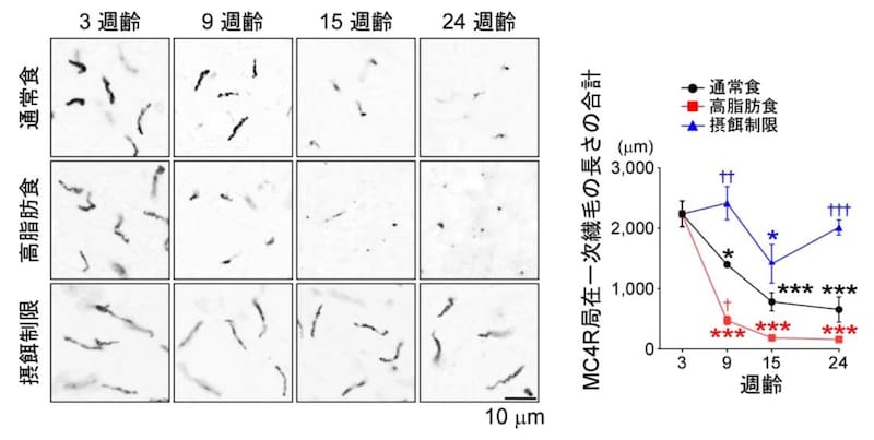 MC4Rが局在する一次繊毛は加齢に伴い短くなっていた。加えて高脂肪食で退縮スピードが上がっていた